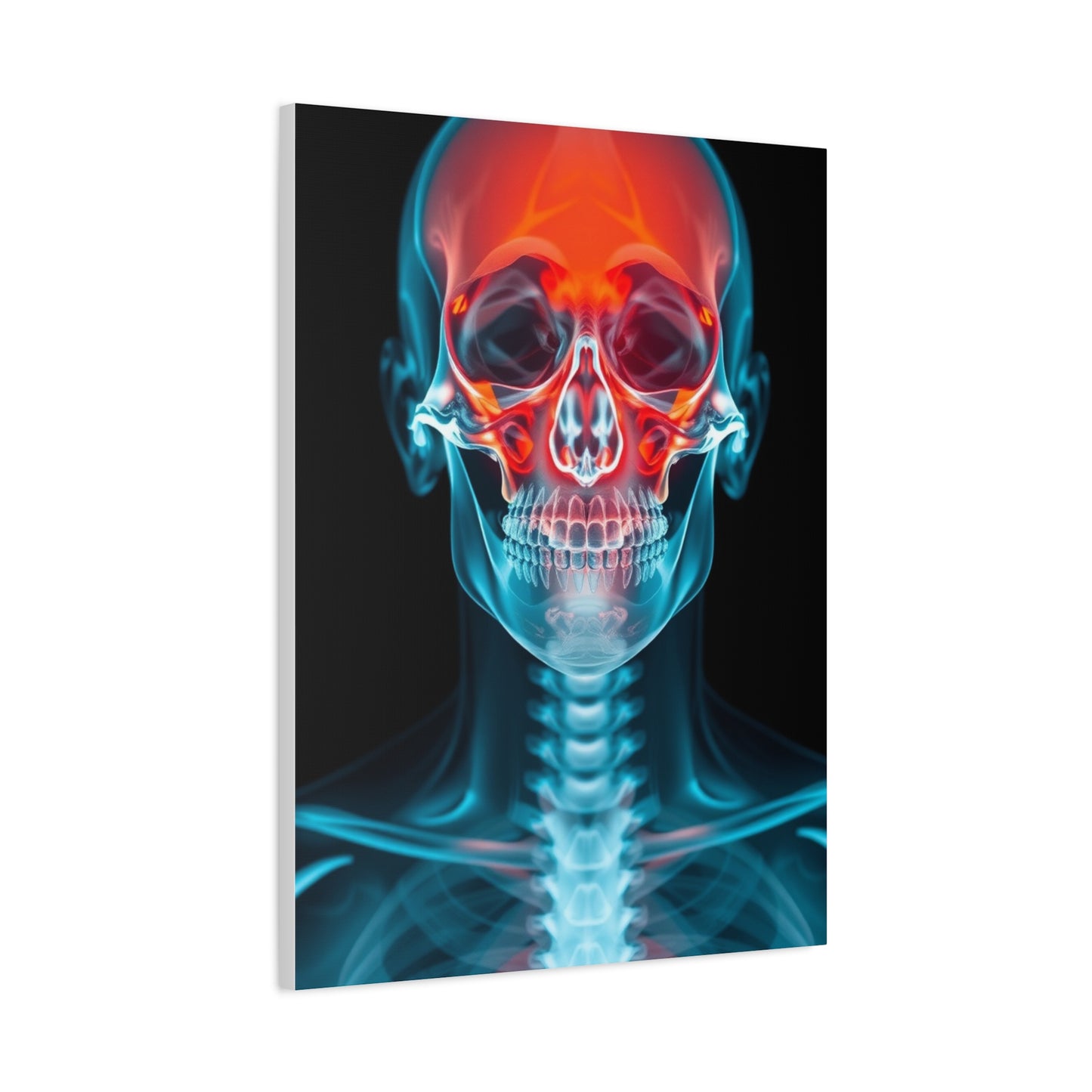 X-Ray Photography Art Supreme Gallery Wall Art & Canvas Print