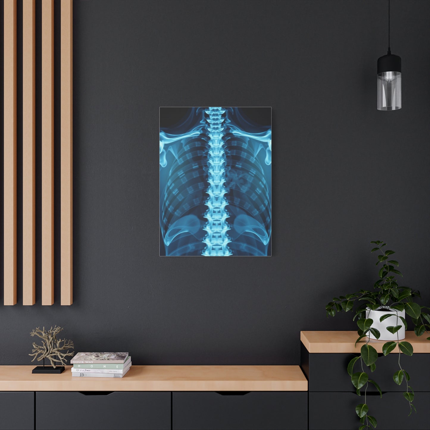 X-Ray Photography Art Supreme Gallery Wall Art & Canvas Print