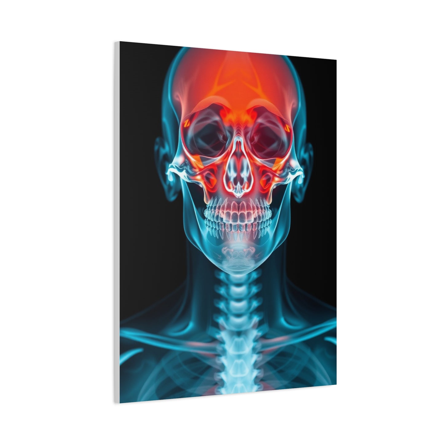 X-Ray Photography Art Supreme Gallery Wall Art & Canvas Print