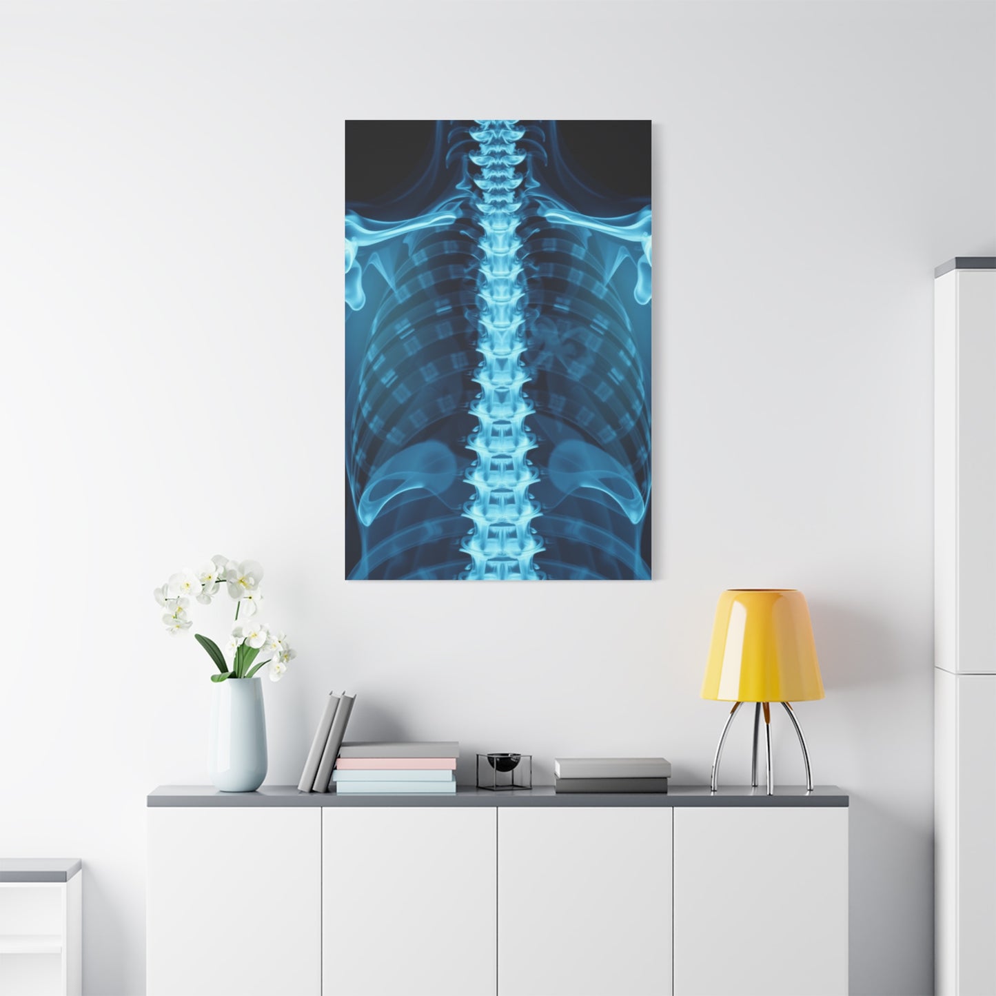 X-Ray Photography Art Supreme Gallery Wall Art & Canvas Print