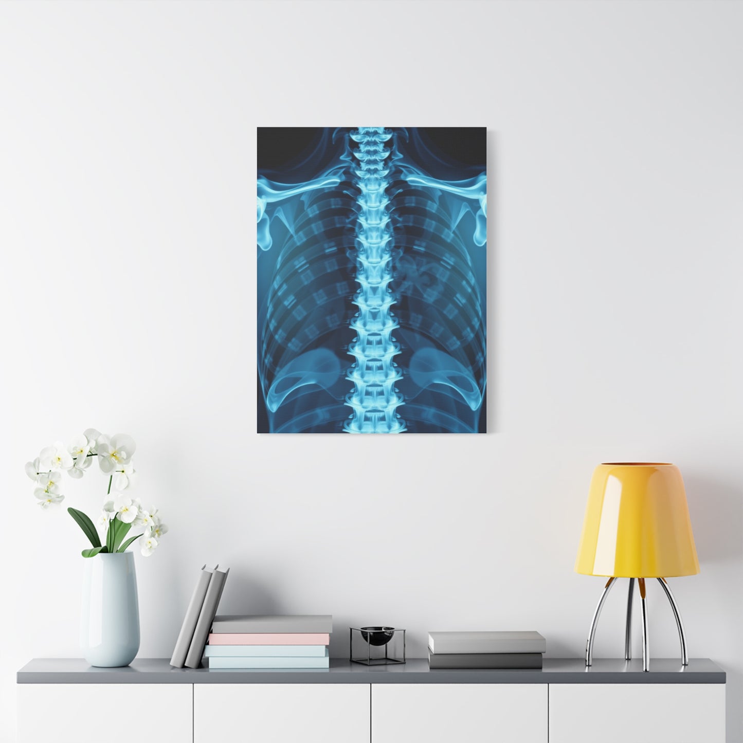 X-Ray Photography Art Supreme Gallery Wall Art & Canvas Print