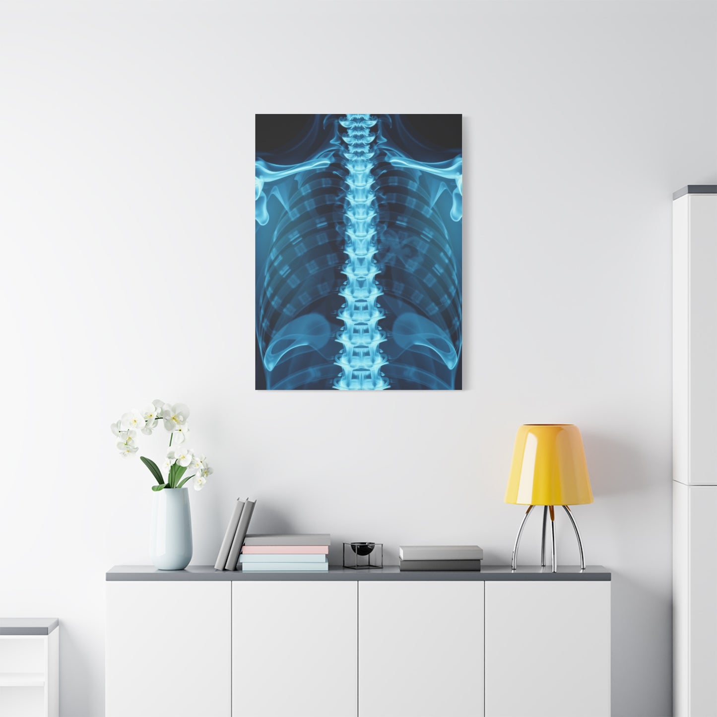 X-Ray Photography Art Supreme Gallery Wall Art & Canvas Print